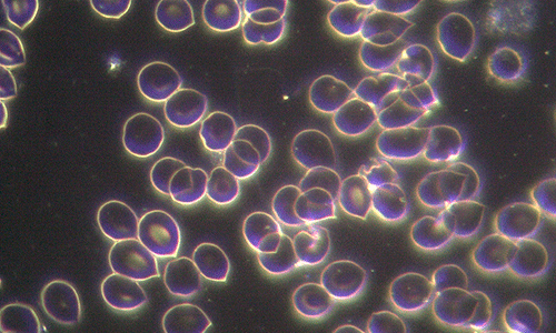 Técnica campo oscuro y fosfenos