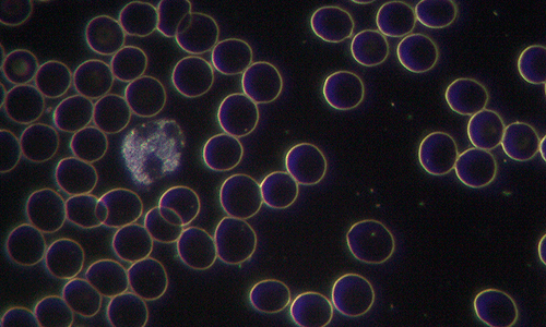microscopio de campo oscuro y fosfenos