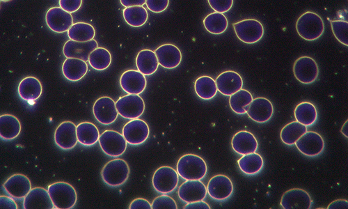 Flujo de información fosfénica y campo oscuro