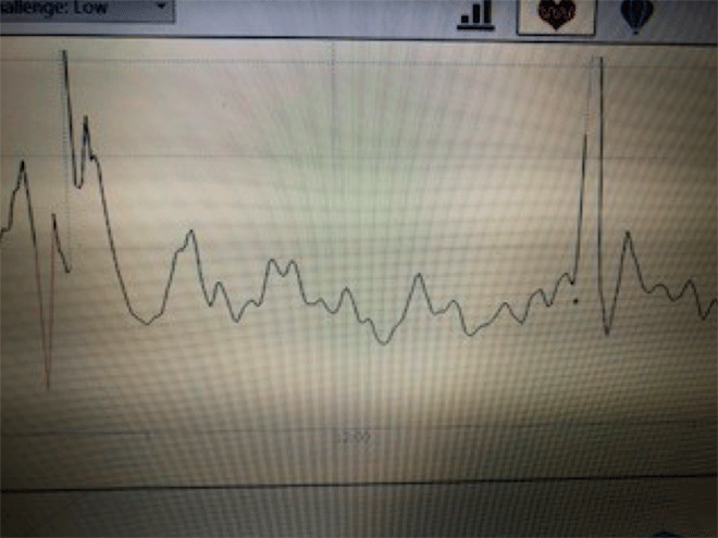 Coherencia cardiaca y cambios en la variabilidad cardiaca